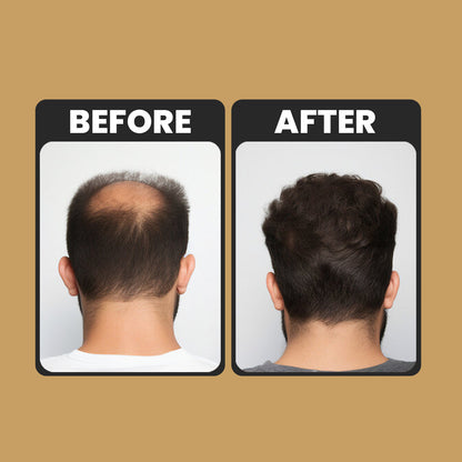 Spartan Root Care Thickening Conditioner for Men & Women